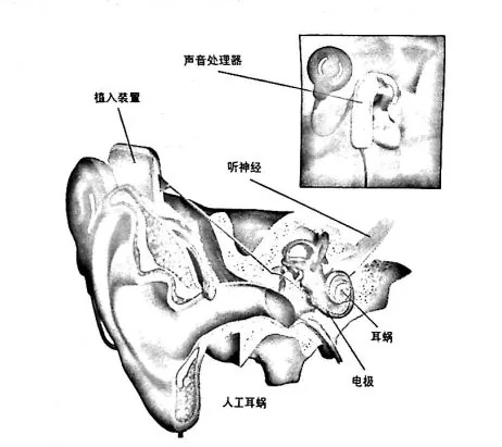 原书插图