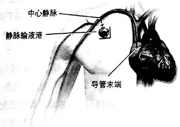 原书插图