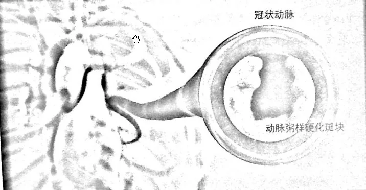 原书插图