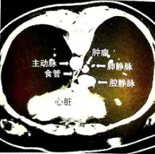 原书插图