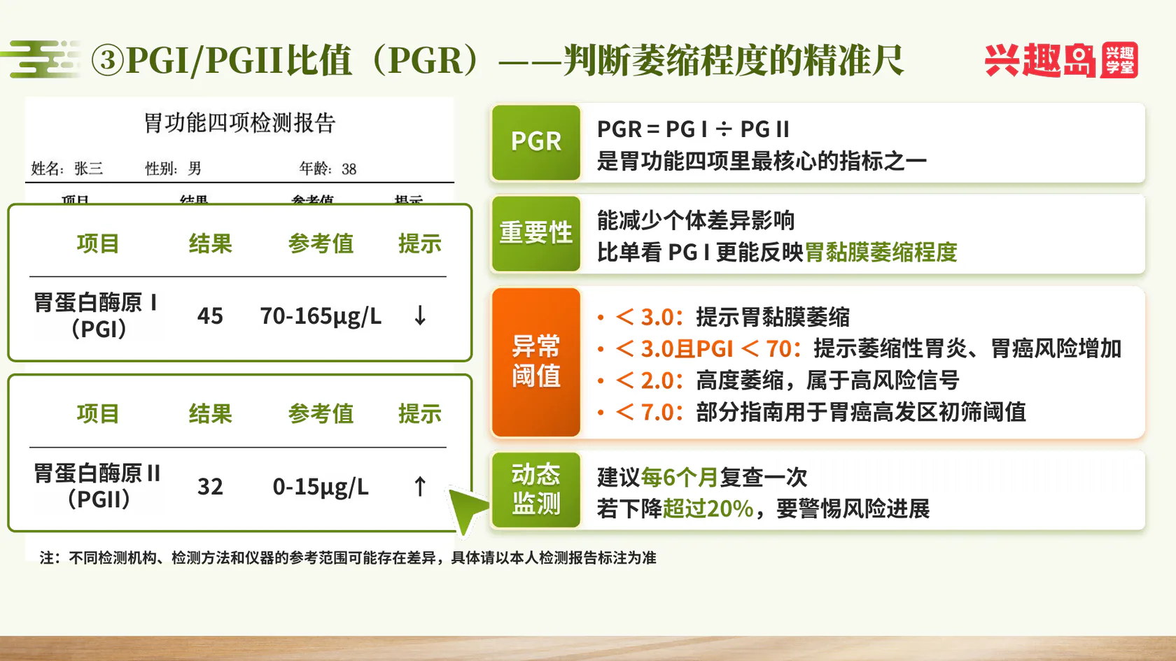 PGI与PGII比值判断萎缩程度