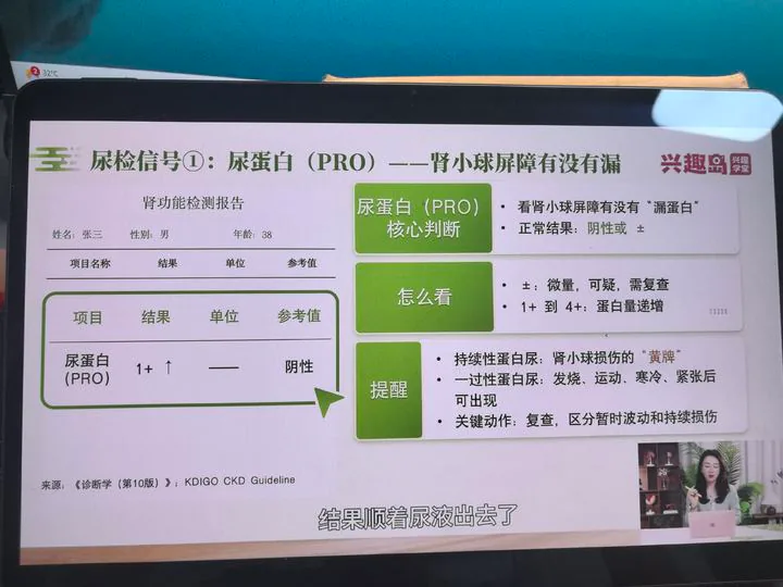 尿蛋白与肾小球屏障