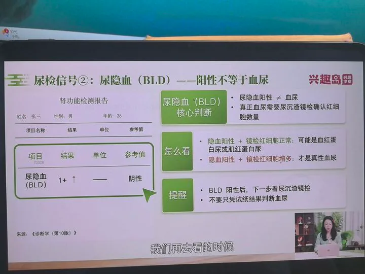 尿隐血与镜检红细胞
