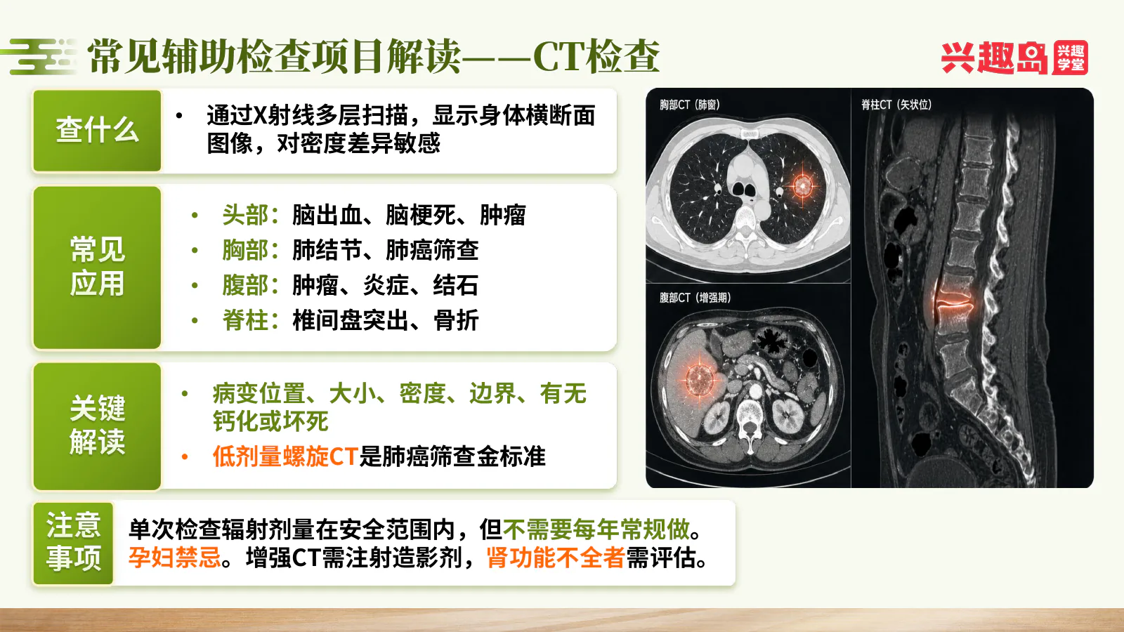 CT检查