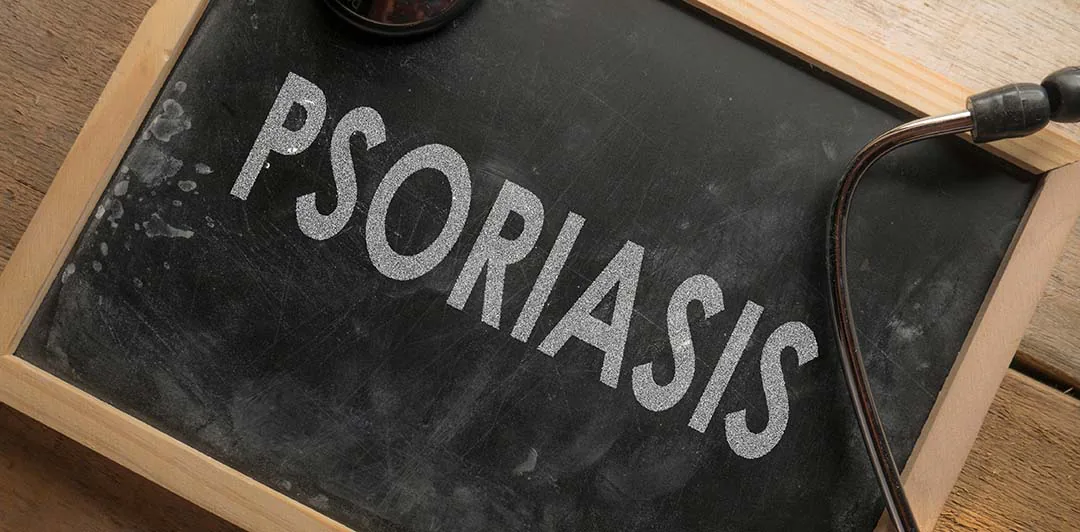 原课程讲首照片:写有PSORIASIS的黑板和听诊器