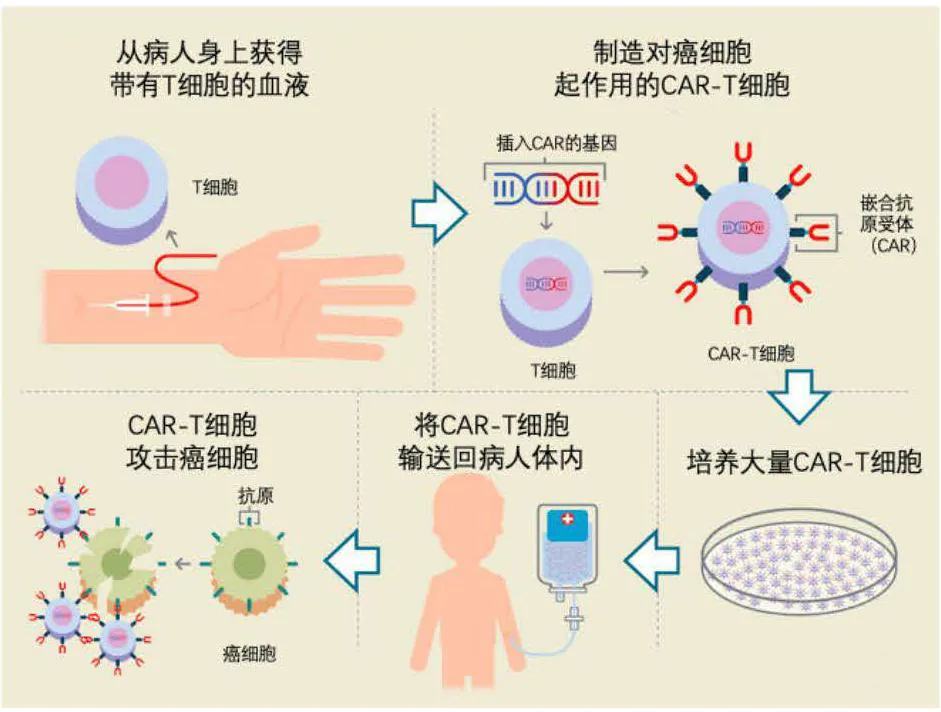 CAR-T疗法示意图