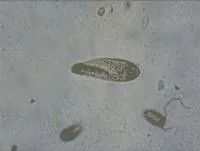 单细胞生物运动的显微影像