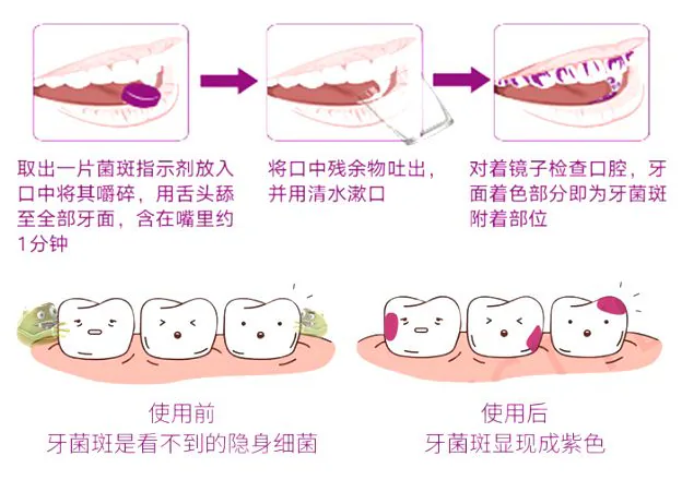 菌斑染色片使用流程