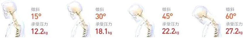 颈椎倾斜15、30、45、60度时承压分别为12.2、18.1、22.2、27.2千克